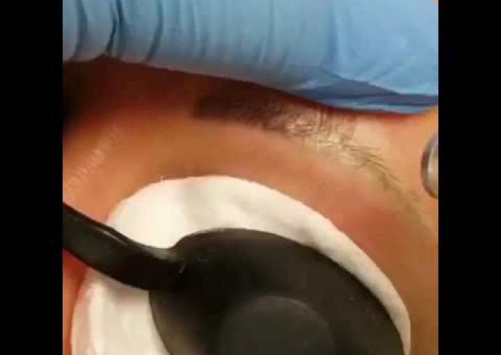 Lion tattoo studio лазерное удаление некачественного татуажа