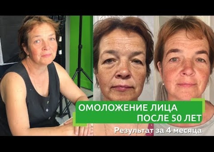 Омоложение лица после 50 лет | Фейсфитнес с Ольгой Малаховой | Фейс фитнес до и после, отзывы