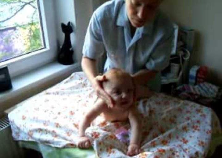 Детский лечебный массаж при врожденней кривошее