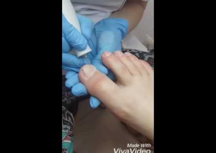 Аппаратный педикюр и покрытие ногтей гель лаком