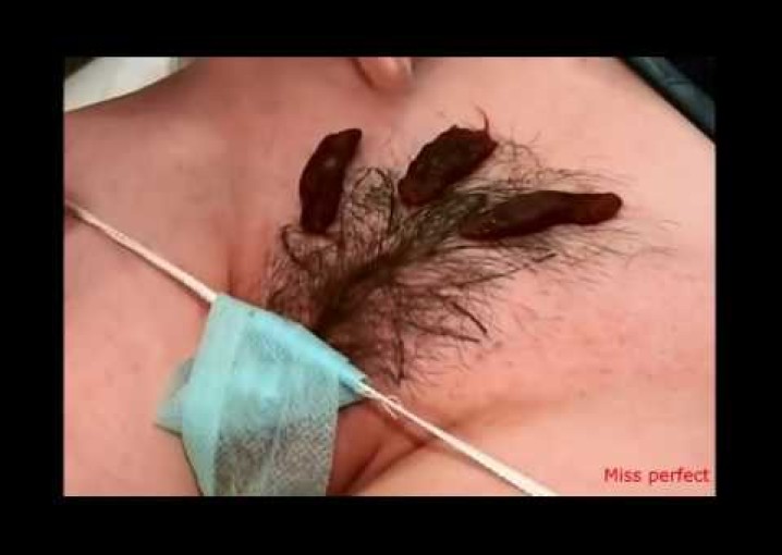 Hair removal Бикини дизайн Глубокая депиляция зоны бикини фитосмолой Все об эпиляции