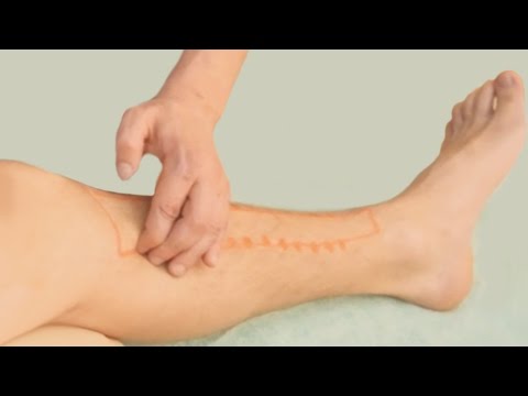 Точечный массаж (акупрессура) нижних конечностей. Spot massage (acupressure) of the leg